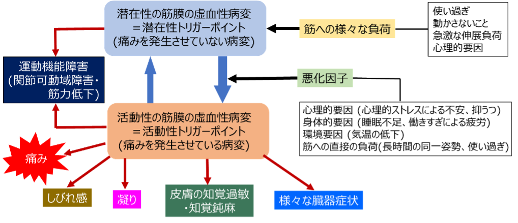 潜在性の筋膜の虚血性病変＝潜在性トリガーポイントと活動性の筋膜の虚血性病変＝活動性トリガーポイントについての図解